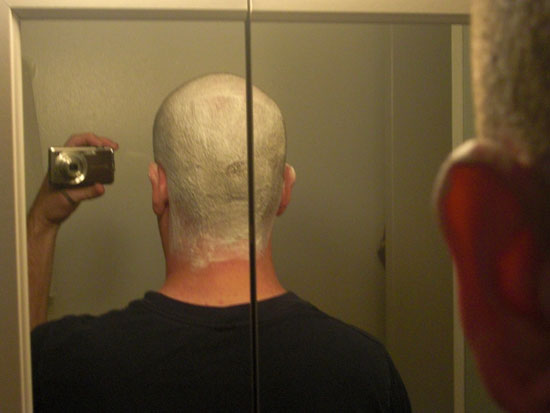 A picture of the back of my head lathered.