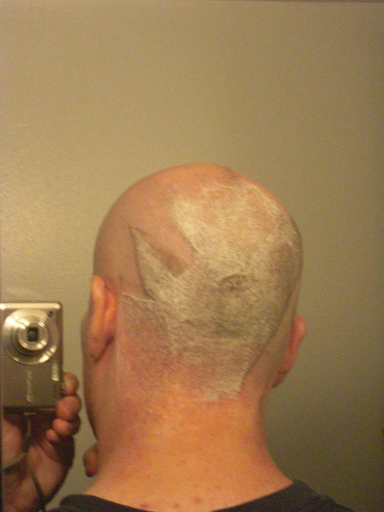 A picture of the back of my head after shaving front and sides of my head