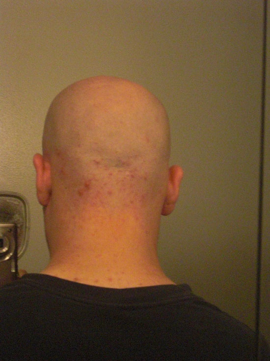 Back of my head after finished shaving